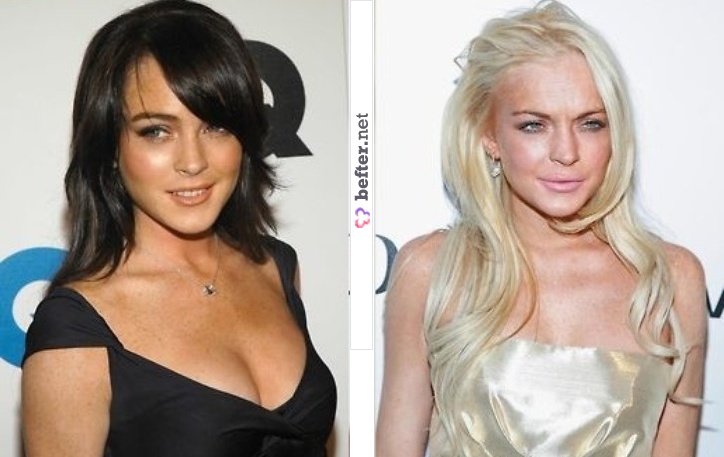 lindsay lohan drugs before after. lindsay lohan drugs before and